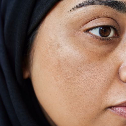 آثار الحبوب